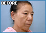 S BEFORE