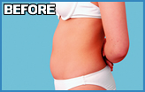 �����܂��̎��b�z�� BEFORE